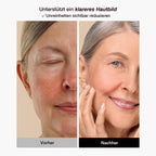 LED Gesichtsmaske – 8 Farben Lichttherapie