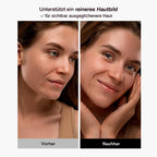 LED Gesichtsmaske – 8 Farben Lichttherapie
